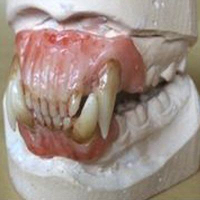 Travaux dentaires